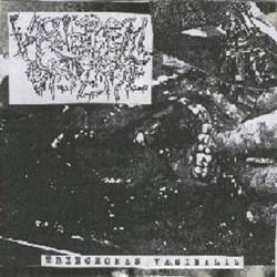 Venereal Disease : Trinchomas Vaginalis